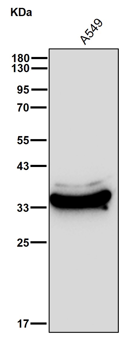 AKR1B10 Ab