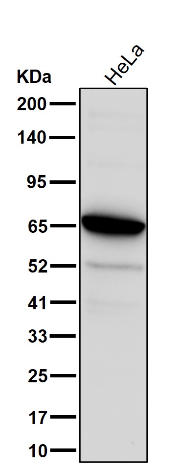 SLC25A13 Ab