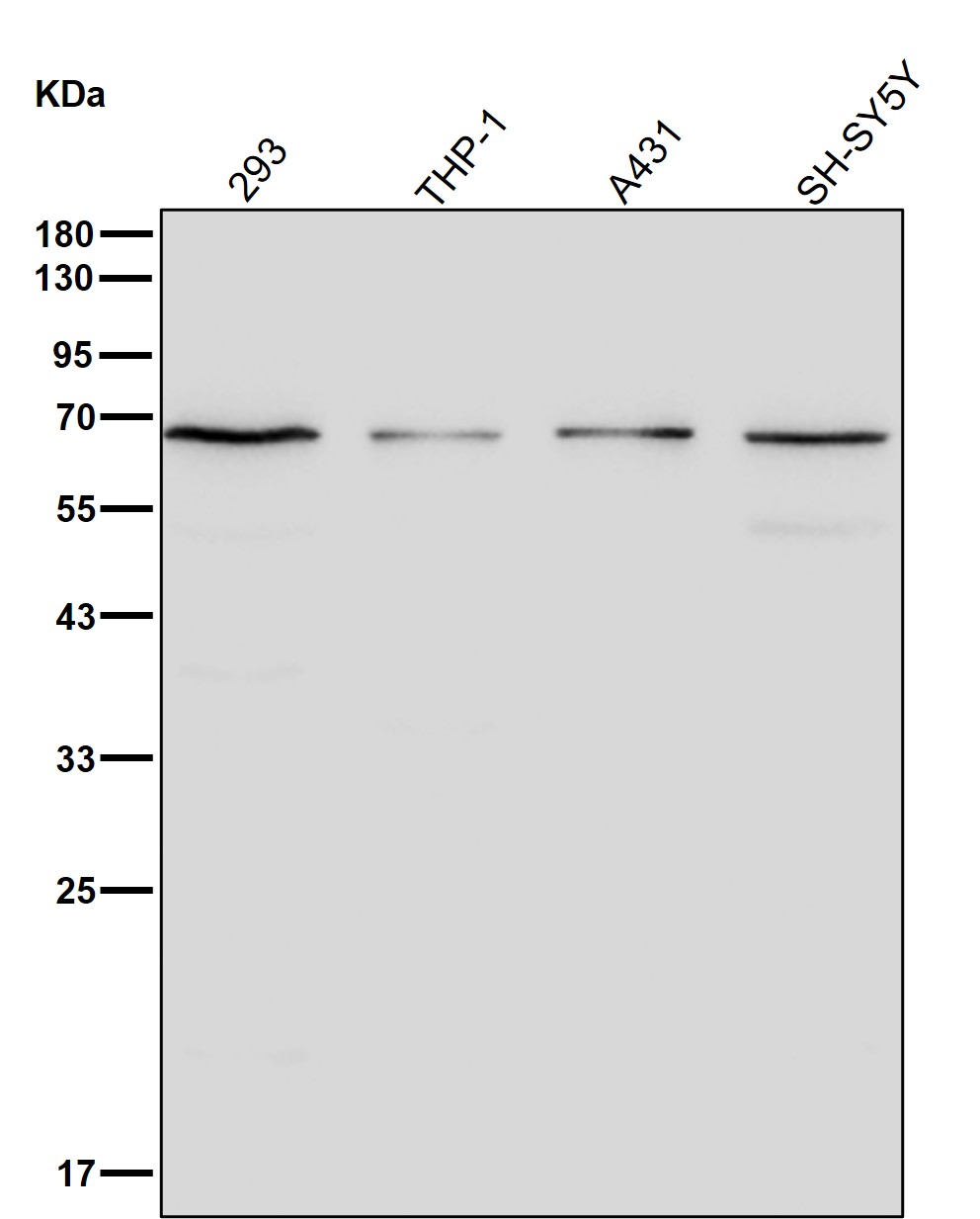 Phosphopentomutase Ab