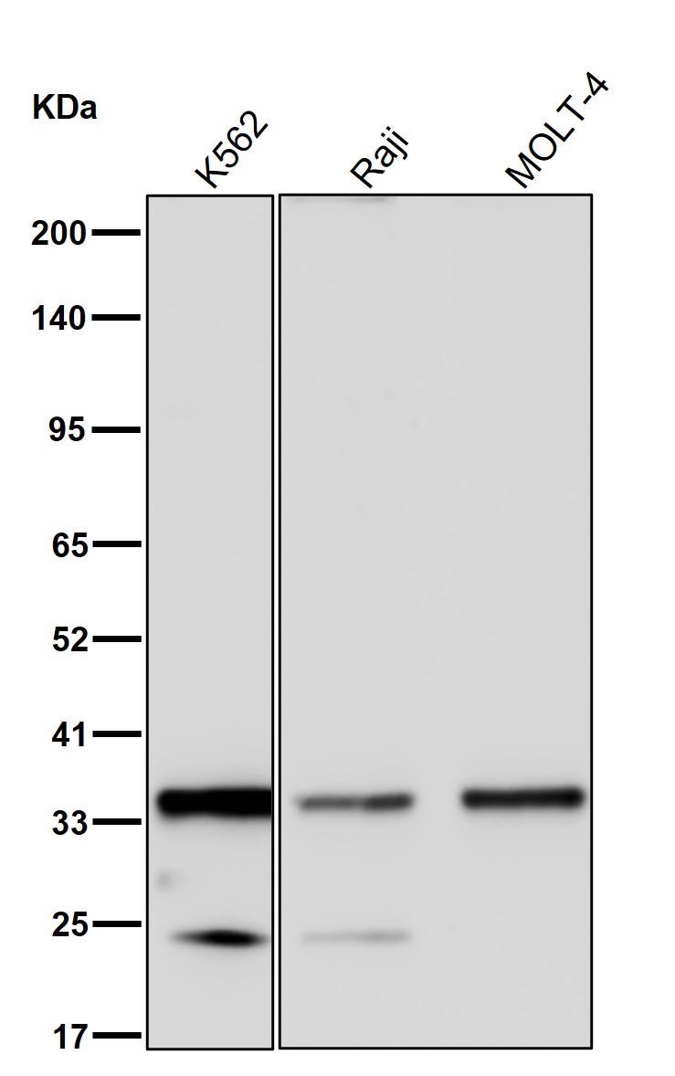 GGPS1 Ab