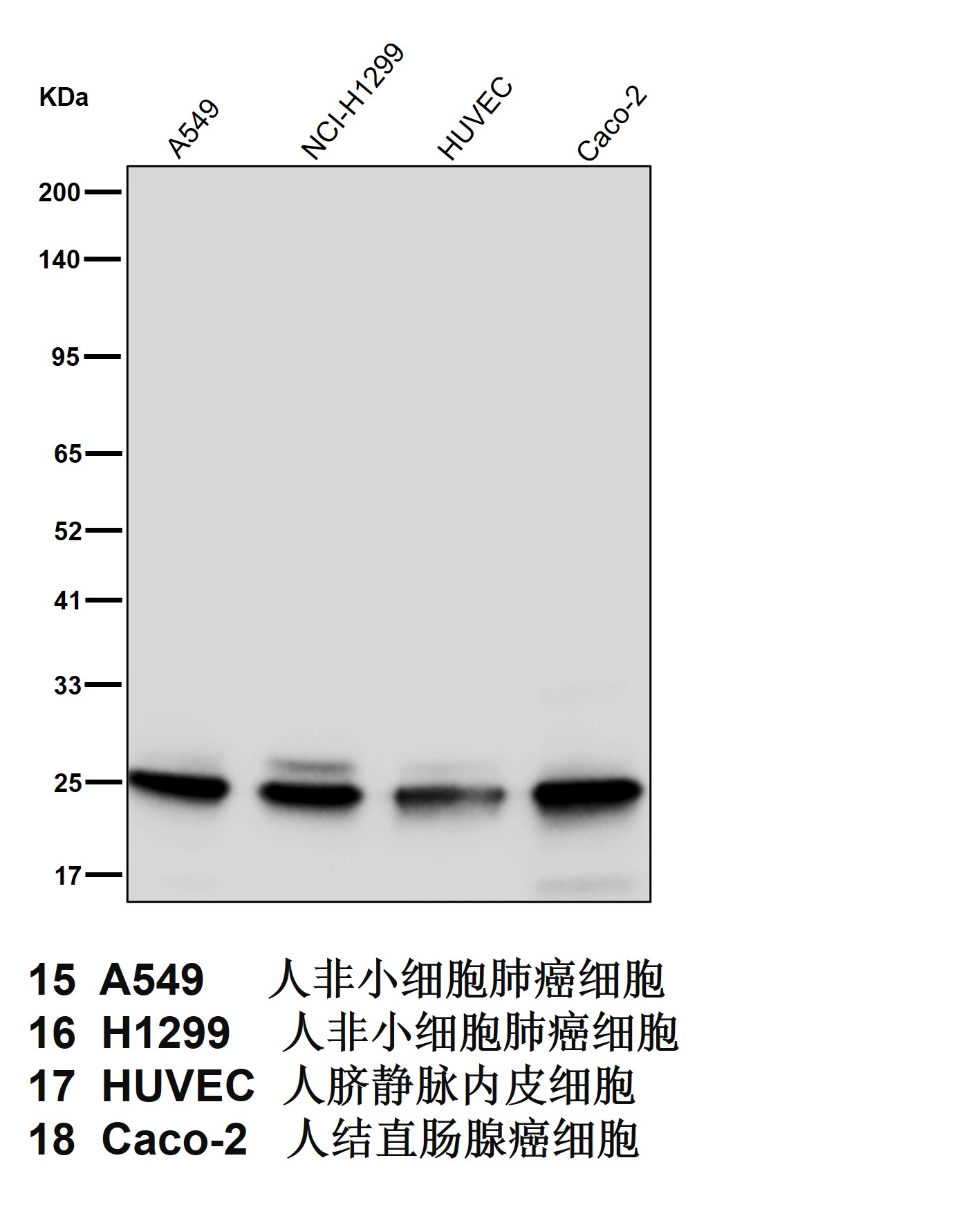 Proteasome 20S beta 6 Ab
