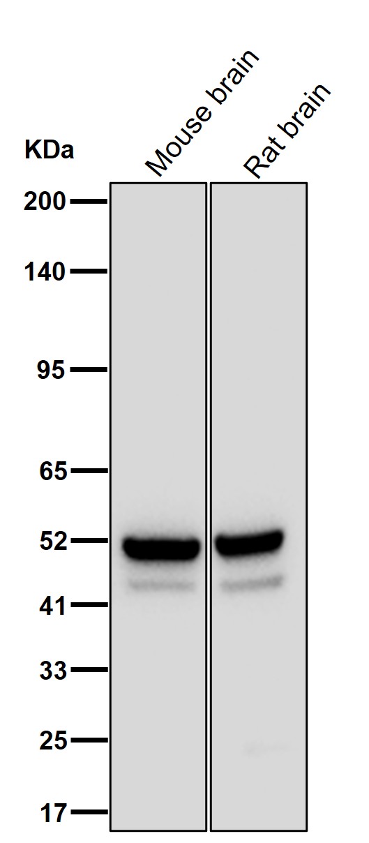 Antithrombin 3 Ab