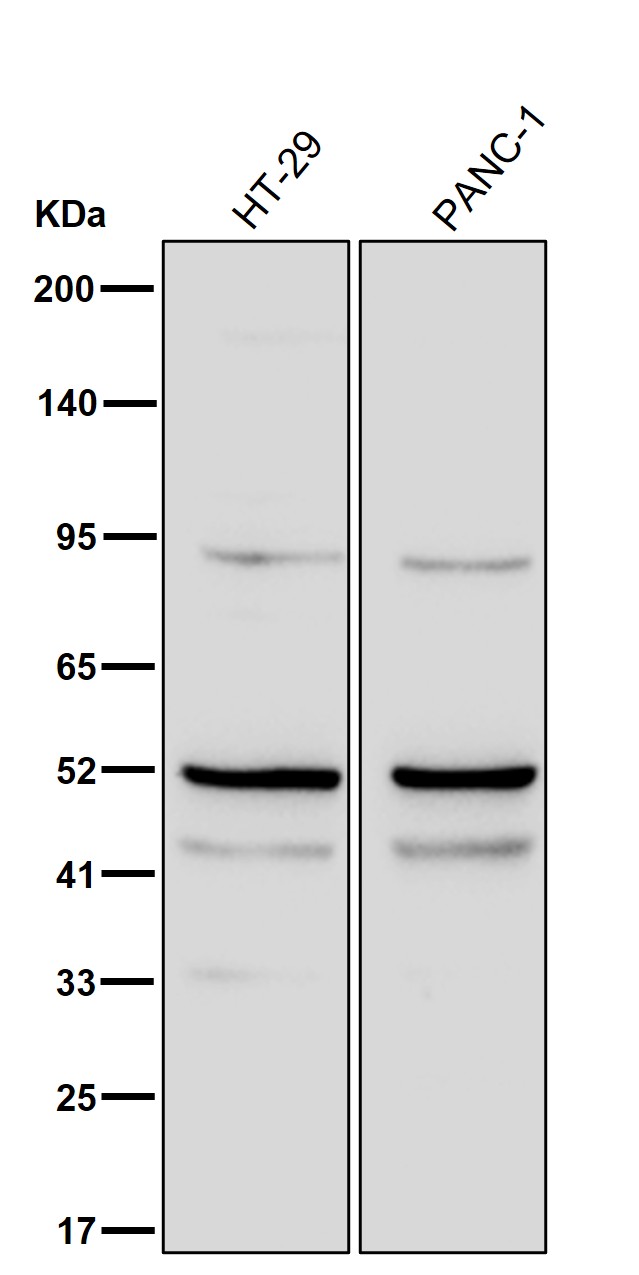 Antithrombin 3 Ab