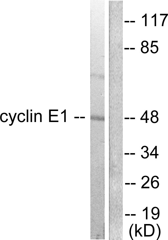 Cyclin E1 Ab