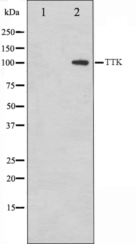 TTK Ab