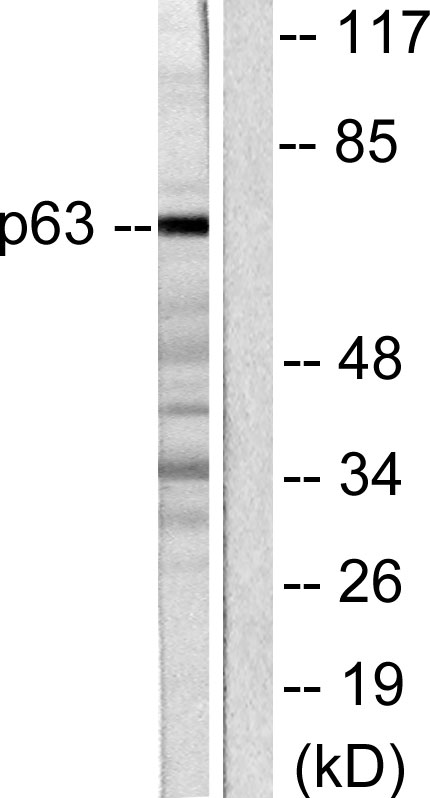 p63 Ab