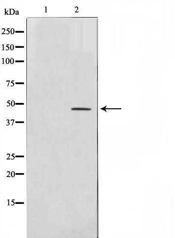 AP 2 Ab
