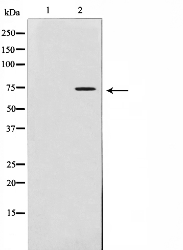 MMP2 Ab