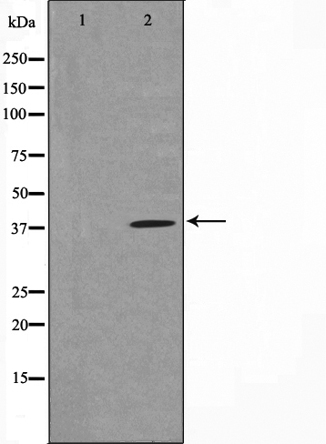 Gastrin Ab