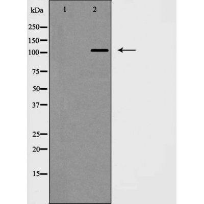 DDR1 Ab