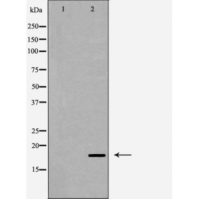 Cleaved-Caspase 6 p11 Ab