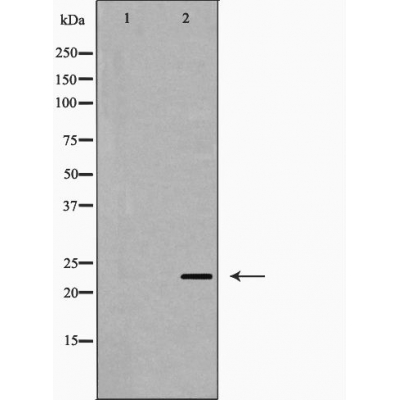IPP 2 Ab