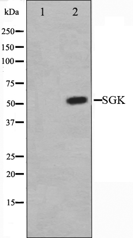 SGK1 Ab