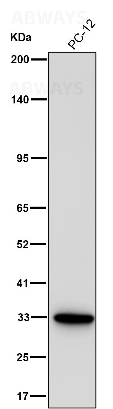 SNAI1 Ab