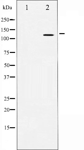 Amyloid beta A4 Ab