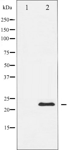 TIMP2 Ab