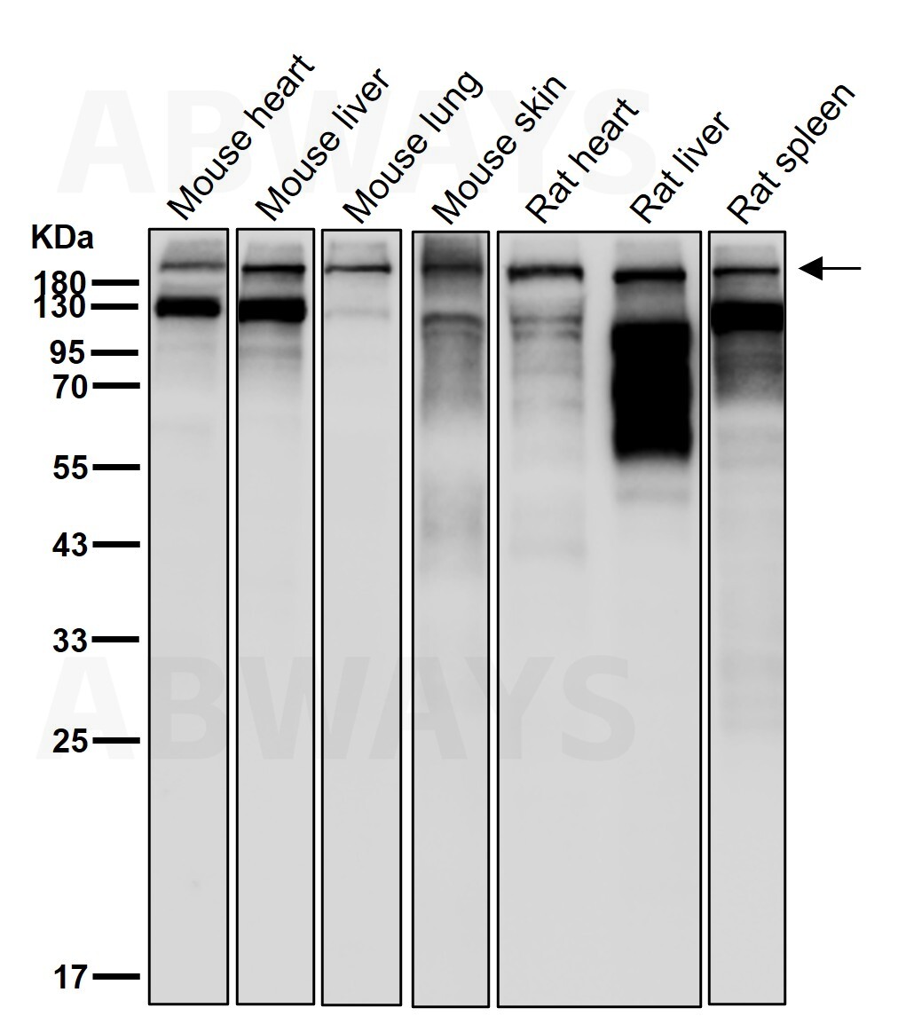 p-Acetyl CoA carboxylase 1 (S80) Ab