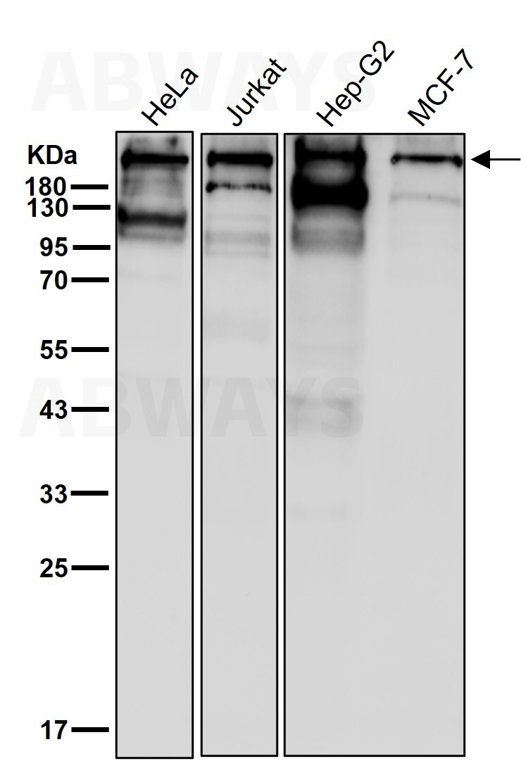 p-Acetyl CoA carboxylase 1 (S80) Ab