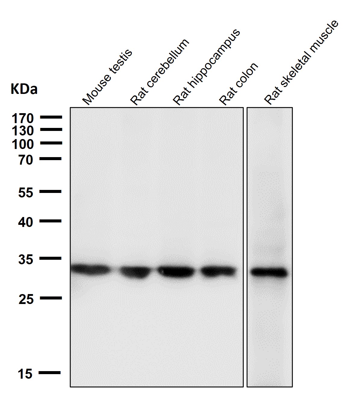 Calponin 1 Ab