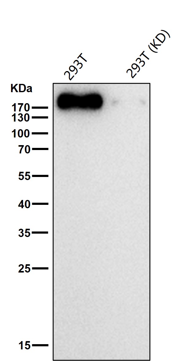 ErbB2 Ab