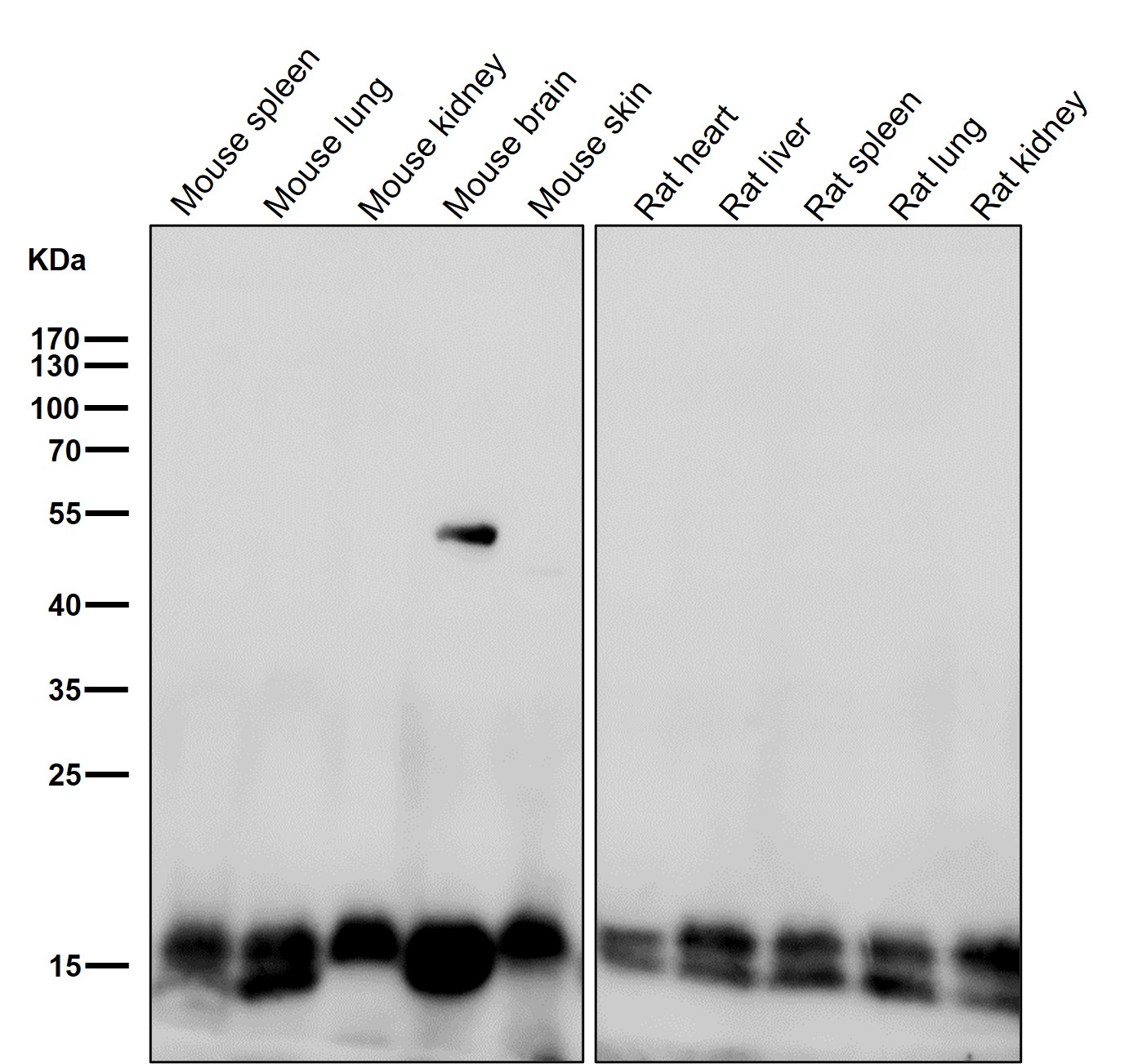 Calmodulin 1 Ab