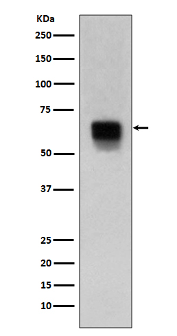 MMP14 Ab