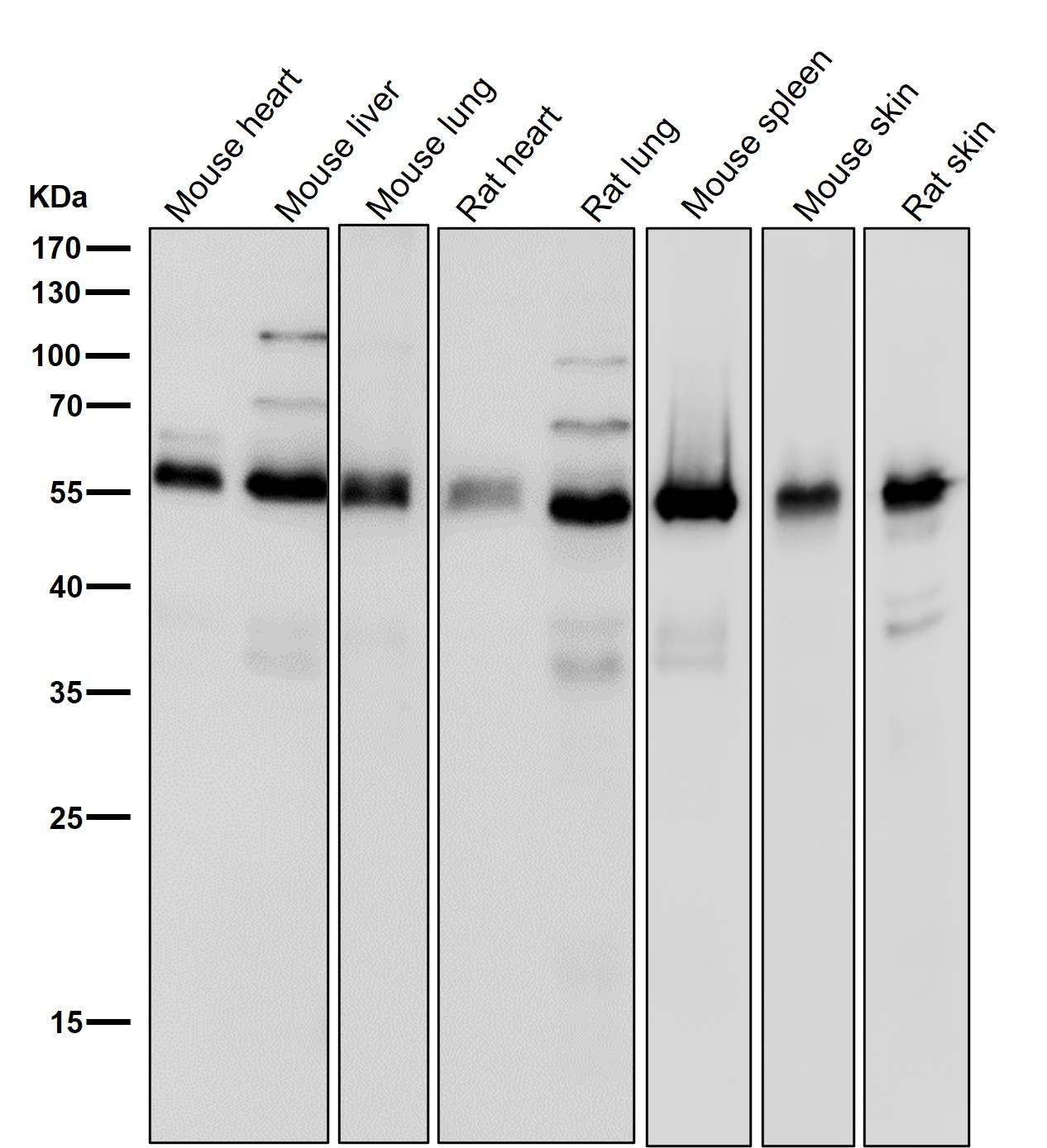 MMP14 Ab