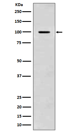 Amyloid beta A4 Ab
