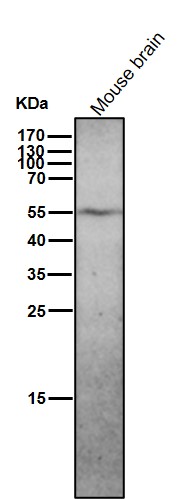 p57 Kip2 Ab