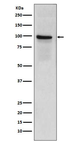 Thrombomodulin Ab