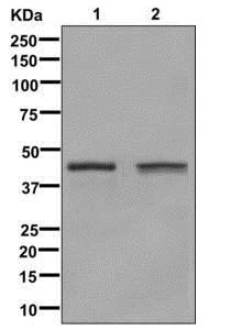 Glutamine synthetase Ab
