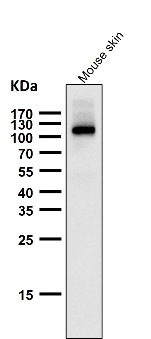 Androgen receptor Ab