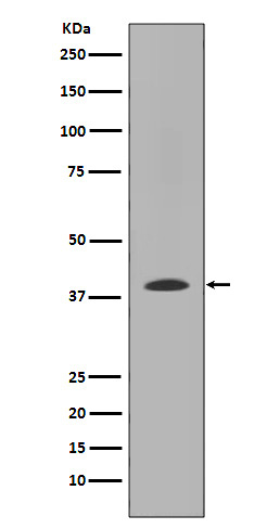 MMP12 Ab