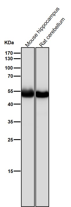 beta 4B/2A/2B Tubulin Ab