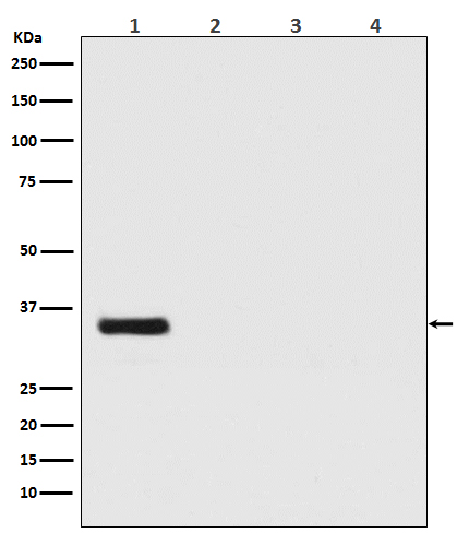Renilla luciferase Ab