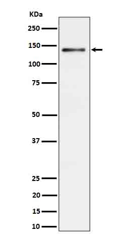Ceruloplasmin Ab