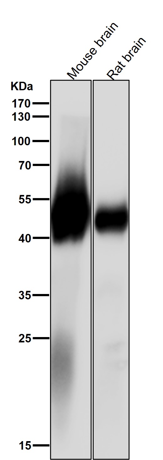 alpha 1B/4A Tubulin Ab