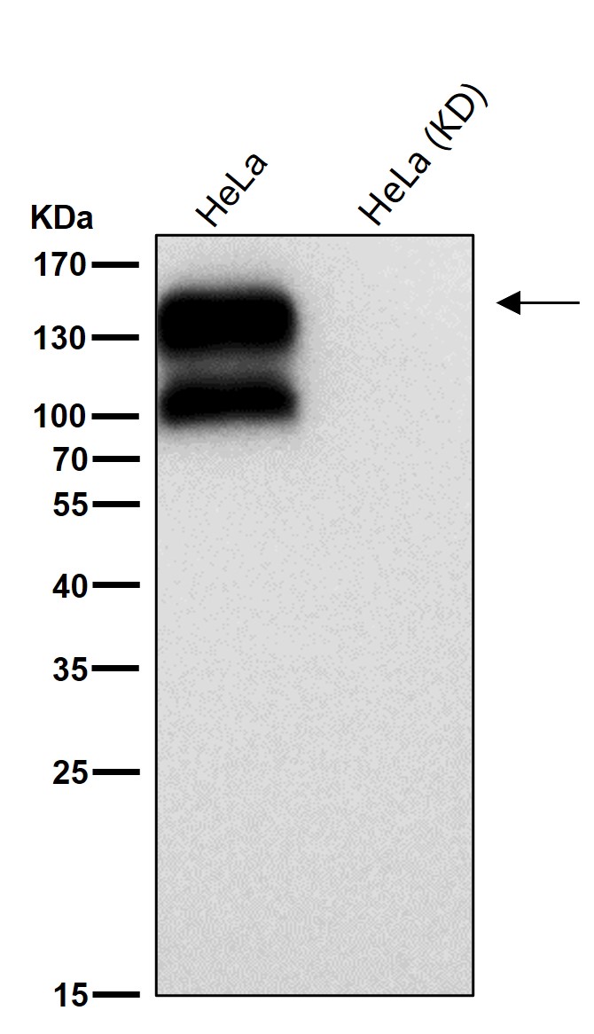 Integrin beta 1 Ab