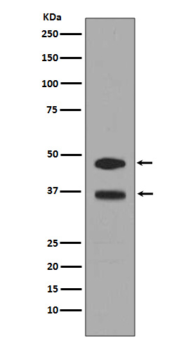 FOSB Ab