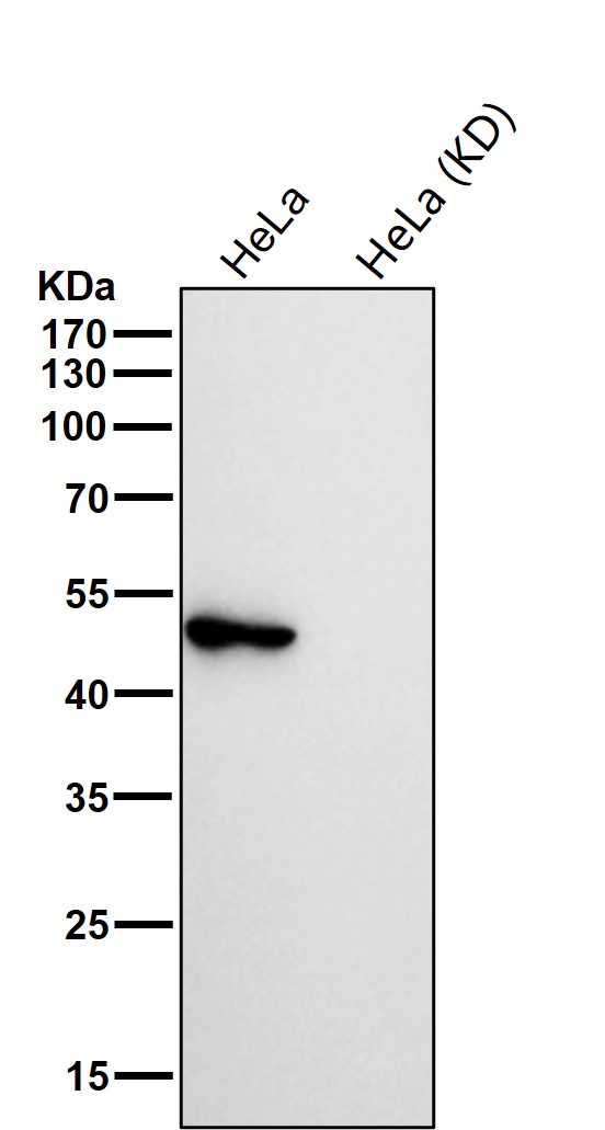 Cytokeratin 17 Ab