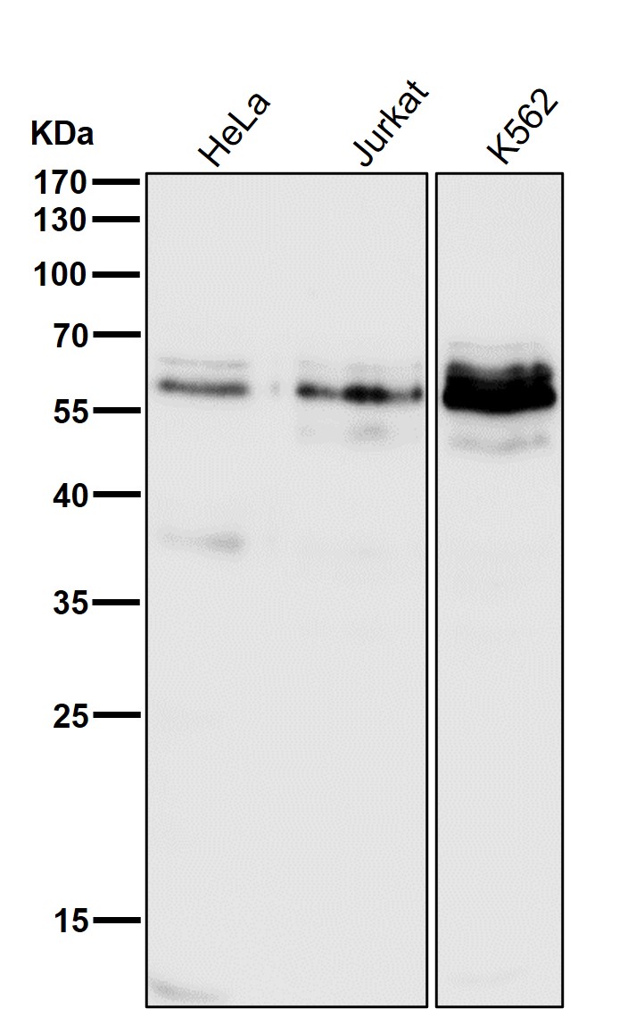 p-c Myc (S62) Ab