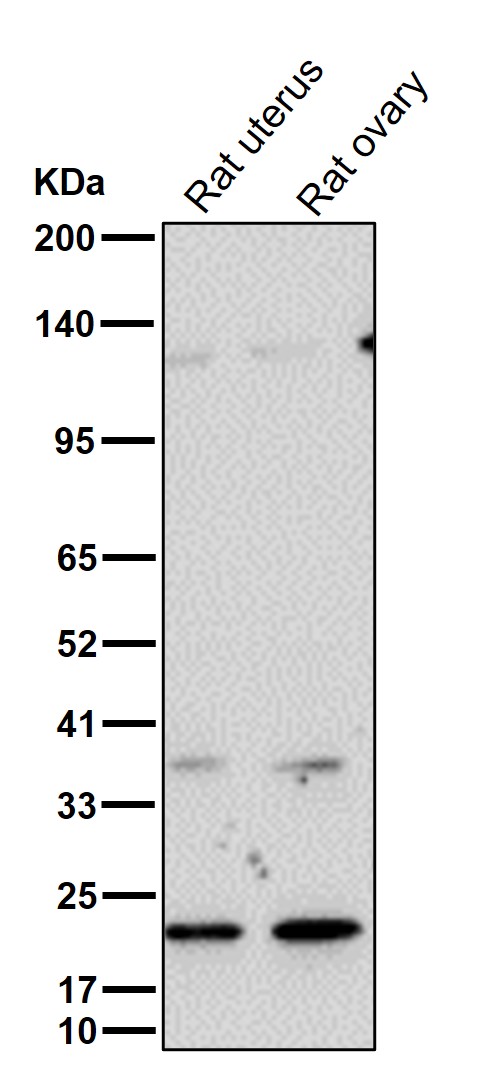 p21 CDKN1A Ab