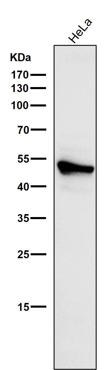 Cytokeratin 7 Ab