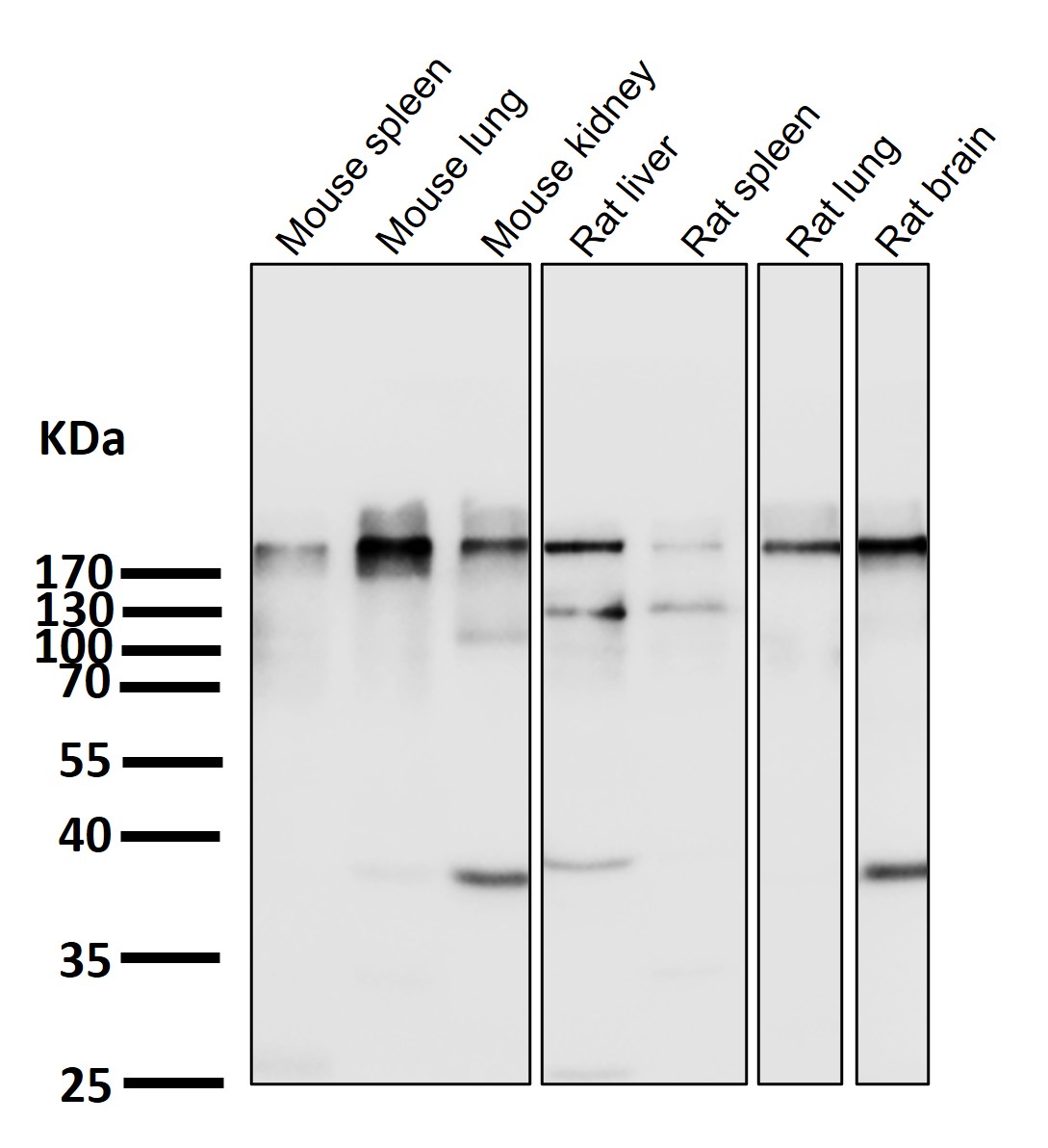 Acetyl CoA carboxylase Ab