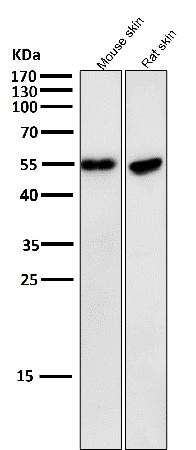 Cytokeratin 10 Ab