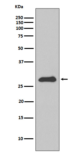 Apolipoprotein A1 Ab