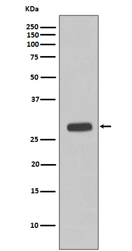 Troponin I Ab