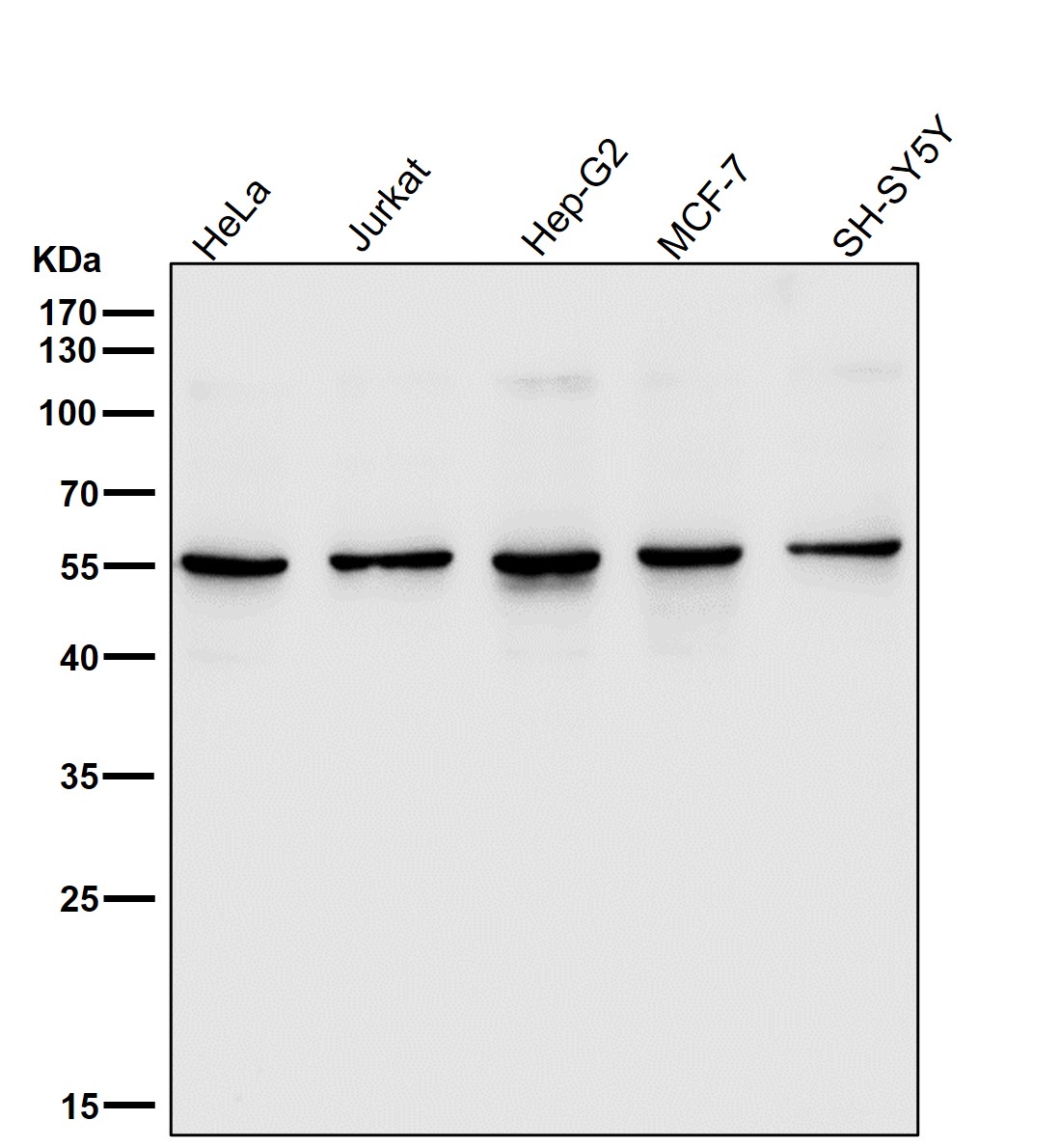 SGK1 Ab