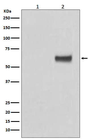 p-Estrogen receptor (S118) Ab