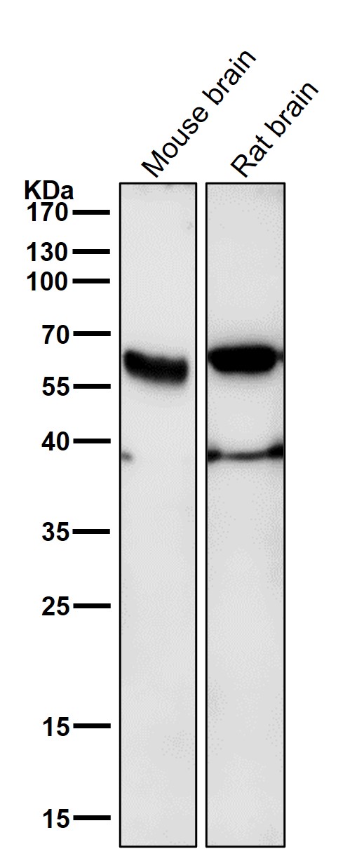 p-Estrogen receptor (S118) Ab